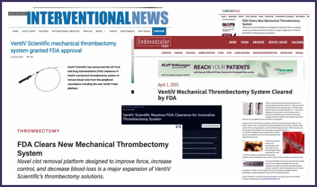 Interventional News Feature
